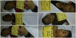 جريمة لمليشات الحوثي توقع خمس شهداء من الأطفال